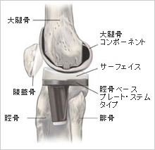 MISのメリット